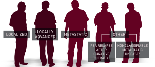 Range of advanced prostate cancer (APC) stages