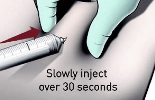 Administering Firmagon® dose step 4: aspirate, then depress